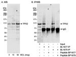 TPX2 Antibody in Western Blot (WB)