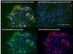 TRA-1-60 Antibody in Immunocytochemistry (ICC/IF)