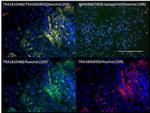 TRA-1-60 Antibody in Immunocytochemistry (ICC/IF)