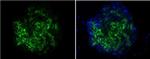 TRA-1-60 Antibody in Immunocytochemistry (ICC/IF)