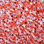 TRADD Antibody in Immunohistochemistry (IHC)