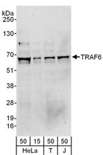 TRAF6 Antibody in Western Blot (WB)