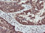 TRAIP Antibody in Immunohistochemistry (Paraffin) (IHC (P))