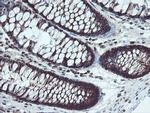 TRAIP Antibody in Immunohistochemistry (Paraffin) (IHC (P))