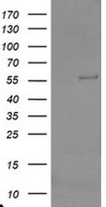 TRAIP Antibody in Western Blot (WB)