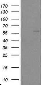 TRAIP Antibody in Western Blot (WB)