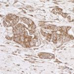 TRAP1/HSP75 Antibody in Immunohistochemistry (IHC)