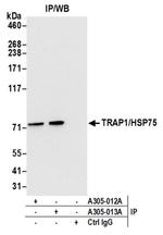 TRAP1/HSP75 Antibody in Western Blot (WB)