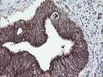 TRAP1 Antibody in Immunohistochemistry (Paraffin) (IHC (P))