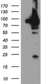 TRAP1 Antibody in Western Blot (WB)