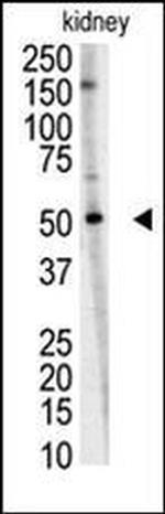 RNF216 Antibody in Western Blot (WB)