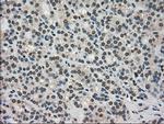 TRIB2 Antibody in Immunohistochemistry (Paraffin) (IHC (P))