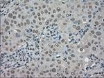 TRIB2 Antibody in Immunohistochemistry (Paraffin) (IHC (P))