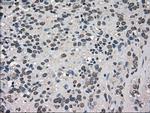 TRIB2 Antibody in Immunohistochemistry (Paraffin) (IHC (P))