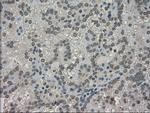 TRIB2 Antibody in Immunohistochemistry (Paraffin) (IHC (P))