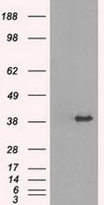 TRIB2 Antibody in Western Blot (WB)