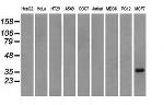 TRIB2 Antibody in Western Blot (WB)