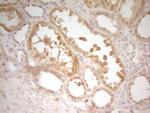 TRIB3 Antibody in Immunohistochemistry (Paraffin) (IHC (P))