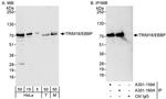 TRIM16/EBBP Antibody in Western Blot (WB)