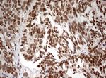 TRIM24 Antibody in Immunohistochemistry (Paraffin) (IHC (P))