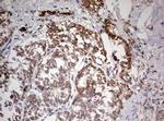 TRIM24 Antibody in Immunohistochemistry (Paraffin) (IHC (P))