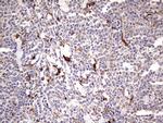 TRIM27 Antibody in Immunohistochemistry (Paraffin) (IHC (P))