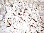 TRIM27 Antibody in Immunohistochemistry (Paraffin) (IHC (P))