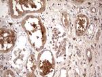 TRIM27 Antibody in Immunohistochemistry (Paraffin) (IHC (P))