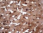 TRIM27 Antibody in Immunohistochemistry (Paraffin) (IHC (P))