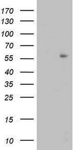 TRIM27 Antibody in Western Blot (WB)