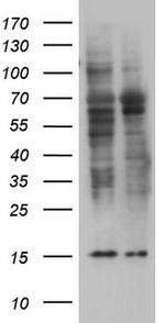 TRIM27 Antibody in Western Blot (WB)