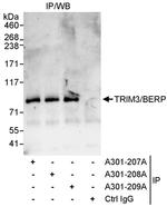 TRIM3/BERP Antibody in Immunoprecipitation (IP)