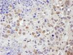 TRIM33/TIF1gamma Antibody in Immunohistochemistry (IHC)