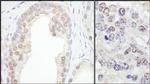 TRIM33/TIF1gamma Antibody in Immunohistochemistry (IHC)