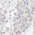 TRIM33/TIF1gamma Antibody in Immunohistochemistry (IHC)