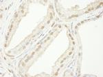 TRIM33/TIF1gamma Antibody in Immunohistochemistry (IHC)