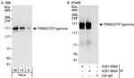 TRIM33/TIF1gamma Antibody in Western Blot (WB)