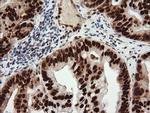 TRIM38 Antibody in Immunohistochemistry (Paraffin) (IHC (P))