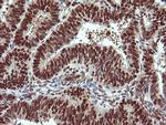 TRIM38 Antibody in Immunohistochemistry (Paraffin) (IHC (P))