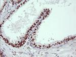 TRIM38 Antibody in Immunohistochemistry (Paraffin) (IHC (P))