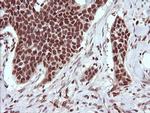 TRIM38 Antibody in Immunohistochemistry (Paraffin) (IHC (P))