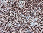 TRIM38 Antibody in Immunohistochemistry (Paraffin) (IHC (P))