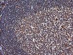 TRIM38 Antibody in Immunohistochemistry (Paraffin) (IHC (P))