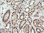 TRIM38 Antibody in Immunohistochemistry (Paraffin) (IHC (P))