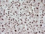 TRIM38 Antibody in Immunohistochemistry (Paraffin) (IHC (P))