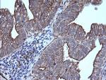 TRIM38 Antibody in Immunohistochemistry (Paraffin) (IHC (P))