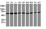 TRIM38 Antibody in Western Blot (WB)