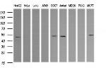 TRIM38 Antibody in Western Blot (WB)