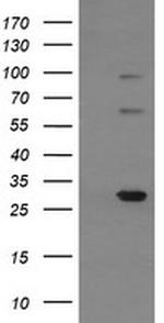 TRIM38 Antibody in Western Blot (WB)