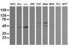 TRIM38 Antibody in Western Blot (WB)